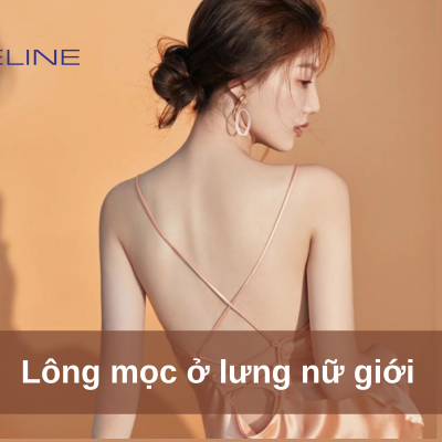Back Hair in Women