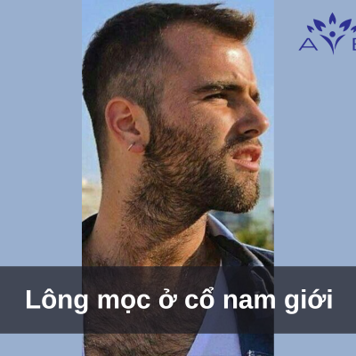 Neck Hair Growth in Men