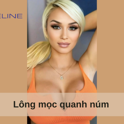 Hair Growth Around the Nipple