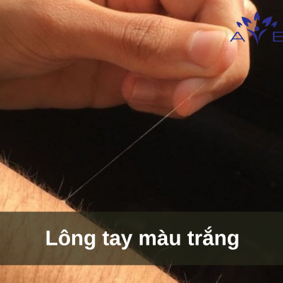 White arm hair
